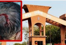 1 वर्षीय बालिका पर तेंदुए का हमला