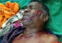बाघ के हमले में चरवाहा गंभीर जख्मी